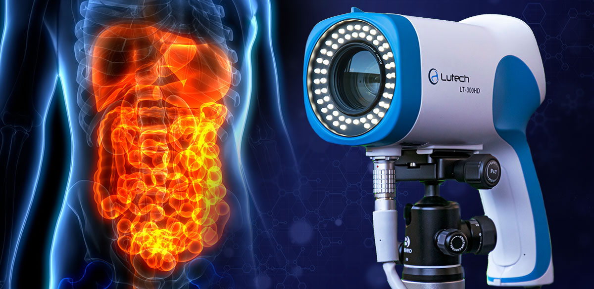 Top 5 Reasons Why You Should Upgrade Your Anoscopy Procedure with the ...